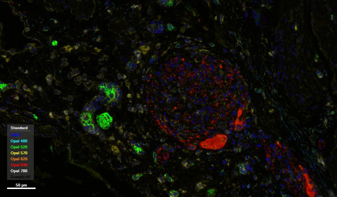 多色免疫荧光试剂盒